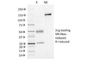 SDS-PAGE Analysis of Purified, BSA-Free FOXA1 Antibody (clone FOXA1/1515). (FOXA1 抗体  (AA 372-472))