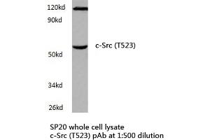 Western blot (WB) analyzes of c-Src antibody in extracts from SP20 cells. (NCOA1 抗体)