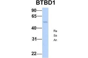Host:  Rabbit  Target Name:  BTBD1  Sample Type:  Human Fetal Lung  Antibody Dilution:  1. (BTBD1 抗体  (N-Term))