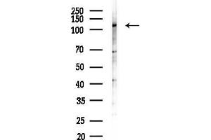 Western blot analysis of lysates from Rat lung, using LRRCC1 Antibody at 1/1000 dilution. (Leucine Rich Repeat and Coiled-Coil Domain Containing 1 (LRRCC1) 抗体)