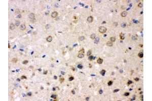 Immunohistochemistry (IHC) image for anti-Amyloid beta (A4) Precursor Protein-Binding, Family B, Member 1 (Fe65) (APBB1) (AA 21-56), (N-Term) antibody (ABIN3043784)