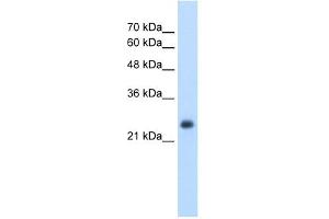 NNMT antibody used at 2.