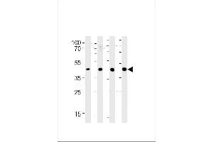 SRD5A3 Antibody (C-term) (ABIN651469 and ABIN2840258) western blot analysis in 293,LNCaP,PC-3,NCI- cell line lysates (35 μg/lane). (SRD5A3 抗体  (C-Term))