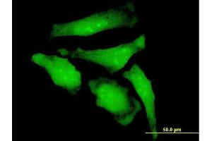 Immunofluorescence (IF) image for anti-RanBP-Type and C3HC4-Type Zinc Finger Containing 1 (RBCK1) (AA 3-99) antibody (ABIN524044)