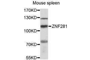 Western blot analysis of extracts of mouse spleen, using ZNF281 antibody (ABIN6291078) at 1:3000 dilution. (ZNF281 抗体)