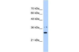 WB Suggested Anti-NMNAT1 Antibody Titration:  0.