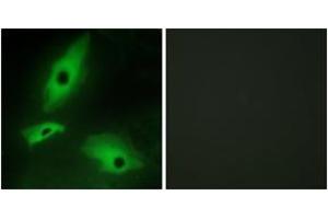 Immunofluorescence analysis of HeLa cells, using LTBR Antibody. (LTBR 抗体  (AA 11-60))