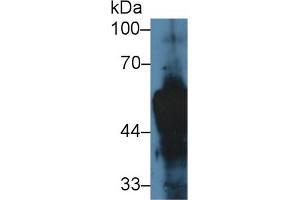 Western blot analysis of Rat Skin lysate, using Rat KRT14 Antibody (5 µg/ml) and HRP-conjugated Goat Anti-Rabbit antibody ( (KRT14 抗体  (AA 122-429))