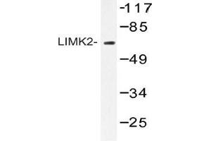 Western blot (WB) analysis of AP20423PU-N LIMK2 antibody in extracts from HepG2 cells. (LIMK2 抗体)