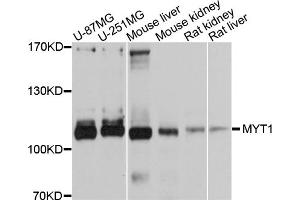 Western blot analysis of extracts of various cell lines, using MYT1 antibody. (MYT1 抗体)