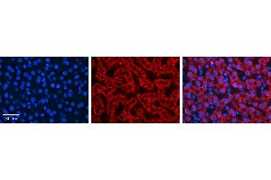 HADH antibody - C-terminal region (ARP54765_P050) Catalog Number: ARP54765_P050  Formalin Fixed Paraffin Embedded Tissue: Human Liver Tissue  Observed Staining: Cytoplasm in mitochondria of hepatocytes Primary Antibody Concentration: 1:600  Secondary Antibody: Donkey anti-Rabbit-Cy3  Secondary Antibody Concentration: 1:200  Magnification: 20X  Exposure Time: 0. (HADH 抗体  (C-Term))
