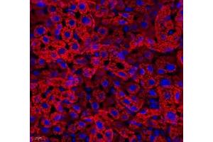 Immunofluorescence (Paraffin-embedded Sections) (IF (p)) image for anti-Aldehyde Dehydrogenase 4 Family, Member A1 (ALDH4A1) antibody (ABIN7073000)