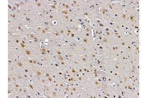ABIN6261786 and ABIN6279146 at 1/100 staining rat brain tissue by IHC-P.