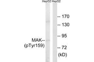 Western blot analysis of extracts from HepG2 cells treated with PMA 125ng/ml 30', using MAK (Phospho-Tyr159) Antibody.