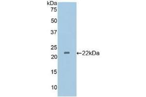 Detection of Recombinant GP4, Mouse using Polyclonal Antibody to Cluster Of Differentiation 36 (CD36) (CD36 抗体  (AA 45-203))