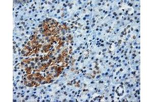 Immunohistochemical staining of paraffin-embedded liver tissue using anti-ATP5Bmouse monoclonal antibody. (ATP5B 抗体)