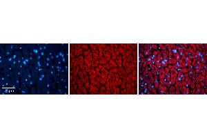Rabbit Anti-TXN2 Antibody Catalog Number: ARP54910_P050 Formalin Fixed Paraffin Embedded Tissue: Human heart Tissue Observed Staining: Cytoplasmic Primary Antibody Concentration: N/A Other Working Concentrations: 1:600 Secondary Antibody: Donkey anti-Rabbit-Cy3 Secondary Antibody Concentration: 1:200 Magnification: 20X Exposure Time: 0. (TXN2 抗体  (Middle Region))