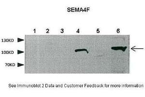 Western Blotting (WB) image for anti-Sema Domain, Immunoglobulin Domain (Ig), Transmembrane Domain (TM) and Short Cytoplasmic Domain, (Semaphorin) 4F (SEMA4F) (N-Term) antibody (ABIN2782624)