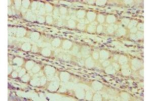 Immunohistochemistry of paraffin-embedded human colon tissue using ABIN7145641 at dilution of 1:100 (BAMBI 抗体  (AA 21-152))