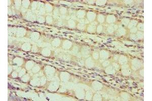 Immunohistochemistry of paraffin-embedded human colon tissue using ABIN7145641 at dilution of 1:100