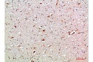 Immunohistochemistry (IHC) image for anti-Tumor Necrosis Factor Receptor Superfamily, Member 9 (TNFRSF9) (AA 111-160) antibody (ABIN7189421)
