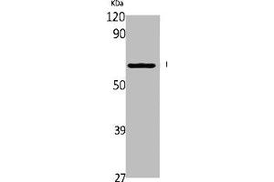 Western Blot analysis of Jurkat cells using CYP2A6/7/13 Polyclonal Antibody