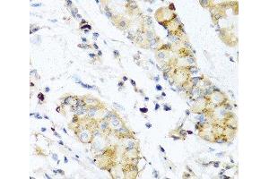 Immunohistochemistry of paraffin-embedded Human stomach using IFNL3 Polyclonal Antibody at dilution of 1:100 (40x lens). (IL28B 抗体)