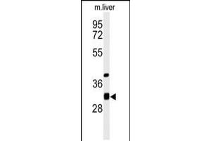Western blot analysis of ECHDC1 Antibody in mouse liver tissue lysates (35ug/lane) (ECHDC1 抗体  (C-Term))