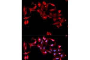Immunofluorescence analysis of A-549 cells using GP9 Polyclonal Antibody (CD42a 抗体)