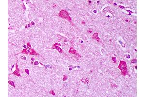 Anti-HSP70 / Heat Shock Protein 70 antibody IHC of human brain, cortex neurons.