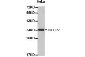 Western Blotting (WB) image for anti-Insulin-Like Growth Factor Binding Protein 2, 36kDa (IGFBP2) antibody (ABIN2650925) (IGFBP2 抗体)