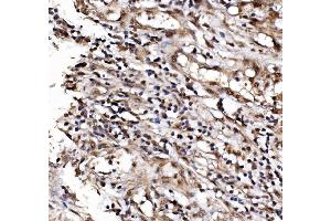 IHC analysis of IFI16 using anti-IFI16 antibody (ABIN7600374). (IFI16 抗体  (AA 183-743))