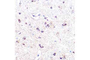 Immunohistochemistry of paraffin-embedded mouse spinal cord using IDO1 Rabbit mAb (ABIN7267863) at dilution of 1:100 (40x lens). (IDO1 抗体)
