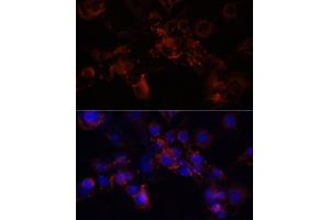 Immunofluorescence analysis of NIH/3T3 cells using STXBP1 antibody (ABIN6128255, ABIN6148673, ABIN6148674 and ABIN6221073) at dilution of 1:100 (40x lens). (STXBP1 抗体  (AA 295-594))