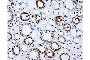 Immunohistochemistry (IHC) image for anti-Proteasome (Prosome, Macropain) 26S Subunit, ATPase, 3 (PSMC3) antibody (ABIN1501331) (PSMC3 抗体)