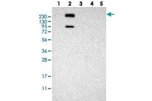 Western blot analysis of Lane 1: RT-4, Lane 2: U-251 MG, Lane 3: Human Plasma, Lane 4: Liver, Lane 5: Tonsil with MPDZ polyclonal antibody . (MPDZ 抗体)