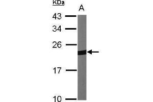 Peroxiredoxin 1 抗体