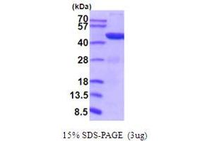 SDS-PAGE (SDS) image for Phosphoglycerate Kinase 1 (PGK1) (AA 1-4170) (Active) protein (His tag) (ABIN5854214)