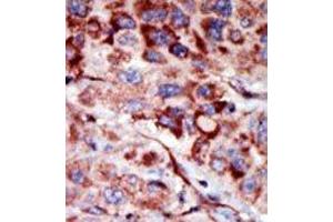 Image no. 2 for anti-Adenylate Kinase 2 (AK2) (C-Term) antibody (ABIN360625) (Adenylate Kinase 2 抗体  (C-Term))