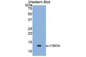 anti-Cystathionine-gamma-Synthase Precursor (CYS) (AA 46-147) antibody