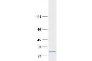 Validation with Western Blot