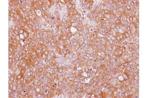 IHC-P Image Immunohistochemical analysis of paraffin-embedded BT474 xenograft, using AHCYL2, antibody at 1:100 dilution. (AHCYL2 抗体)