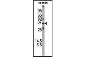 Western blot analysis using ATG5 Antibody (N-term) Cat. (ATG5 抗体  (N-Term))