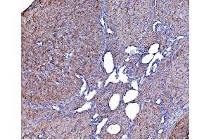 IHC analysis of PDIA6 using anti-PDIA6 antibody (ABIN7600553). (PDIA6 抗体  (AA 20-440))