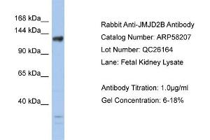 WB Suggested Anti-JMJD2B  Antibody Titration: 0. (KDM4B 抗体  (Middle Region))