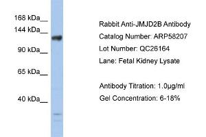 WB Suggested Anti-JMJD2B  Antibody Titration: 0.