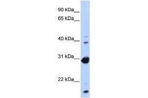 WB Suggested Anti-NR0B2 Antibody Titration:  0. (NR0B2 抗体  (Middle Region))