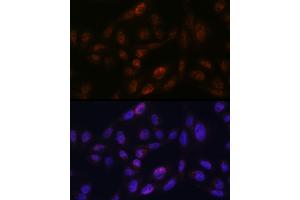 Immunofluorescence analysis of U2OS using SMC3 antibody (ABIN7270616) at dilution of 1:100. (SMC3 抗体)