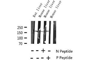 Western blot analysis of Phospho-EGFR (Ser1070) expression in various lysates (EGFR 抗体  (pSer1070))