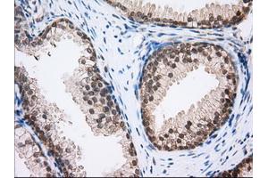 Immunohistochemical staining of paraffin-embedded Human Kidney tissue using anti-MTRF1L mouse monoclonal antibody. (MTRF1L 抗体)